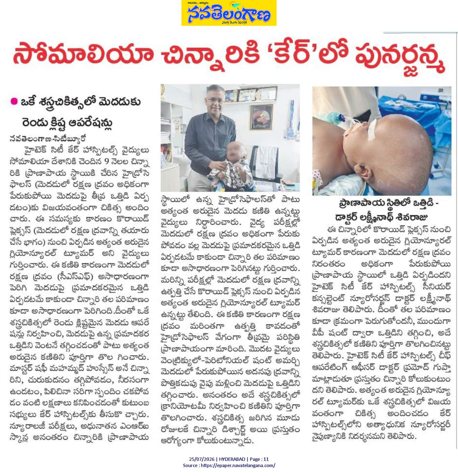 Nava Telangana reported the successful treatment of a 9-month-old infant with a rare brain tumour by Dr. Laxminadh Sivaraju at CARE Hospitals, Hyderabad. The coverage highlights advanced pediatric brain surgery, hydrocephalus management, multidisciplinary neurosurgical care, and excellence in complex neurological procedures.
